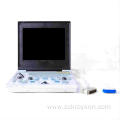 Male gallbladder polyps ultrasound diagnosis instrument